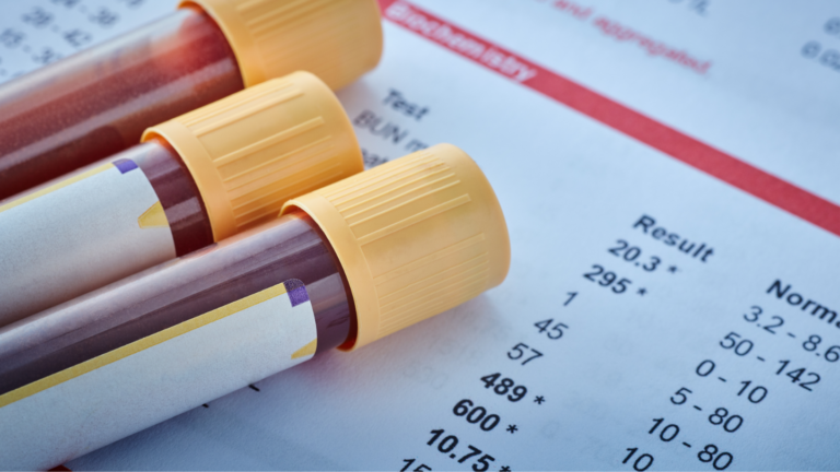 Blood tests